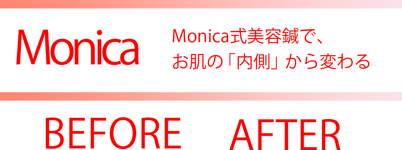 Monica美容鍼ビフォーアフター